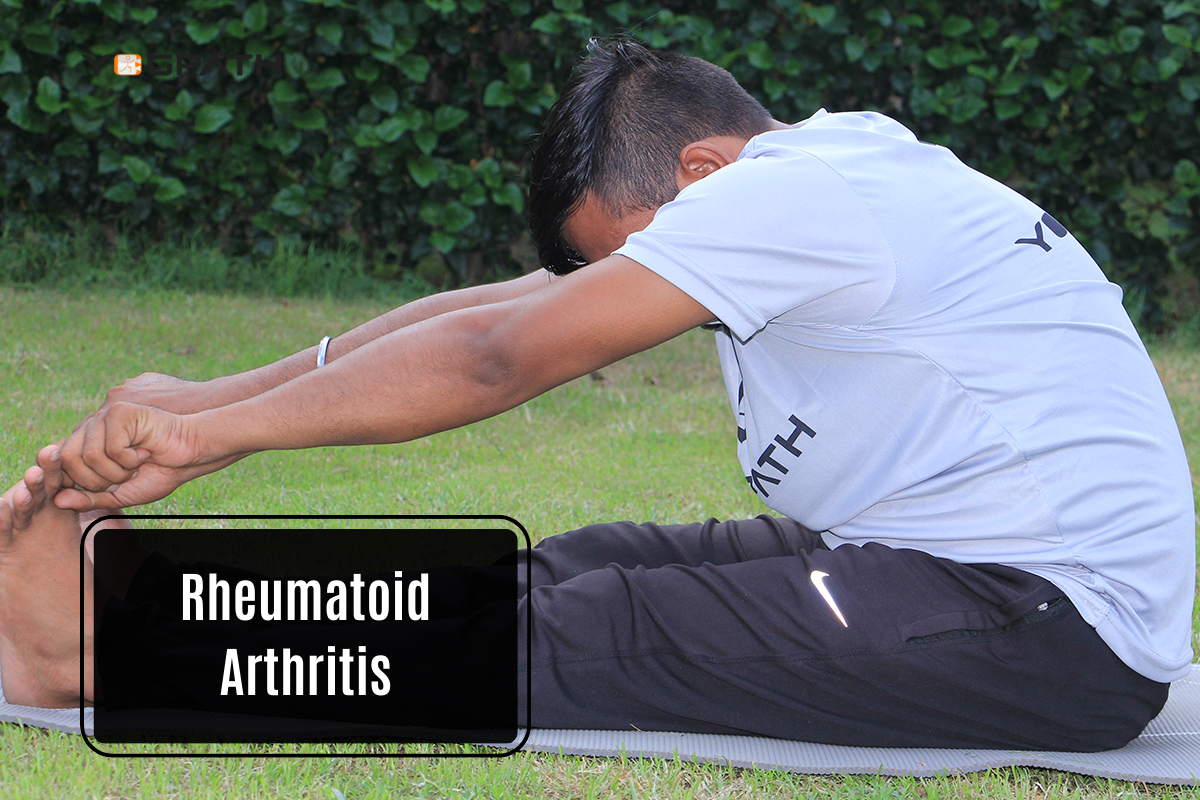 Rheumatoid Arthritis with Yoga